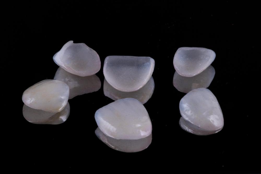 dental veneers