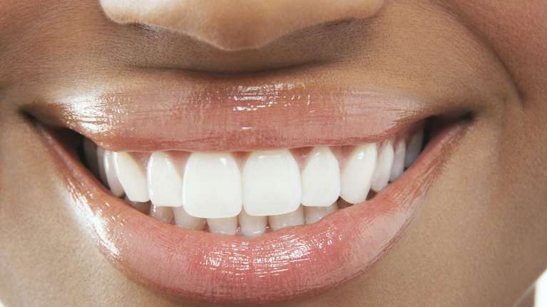woman smiling after getting a dental exam in midtown manhattan
