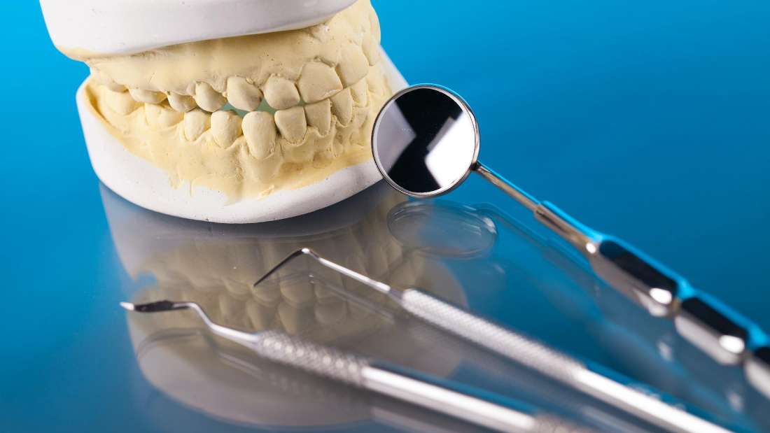 dental tools and mould of teeth